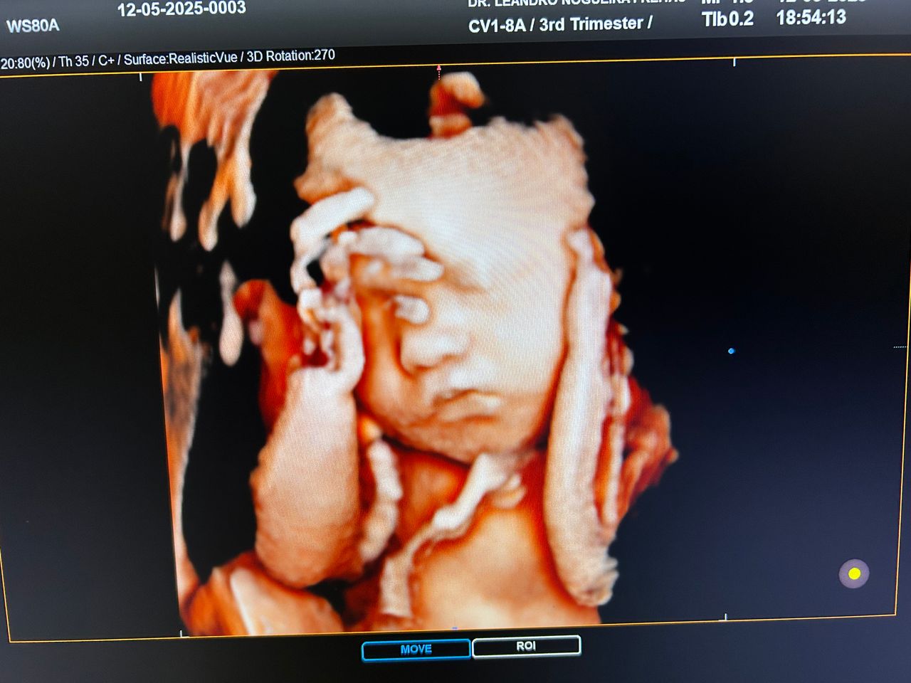 Leandro Nogueira Freitas-2