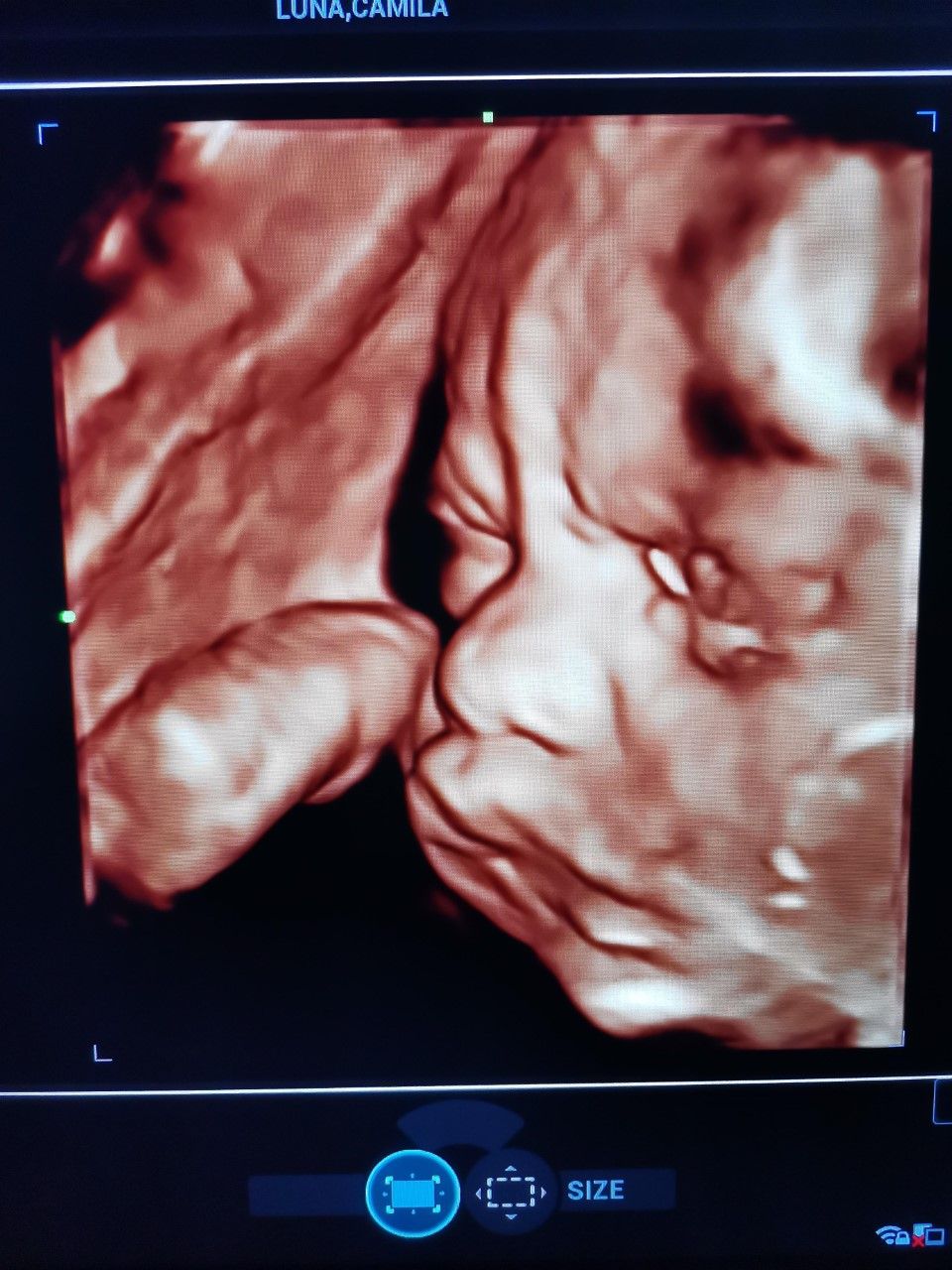 Marcelo Fierro Jarrin-13