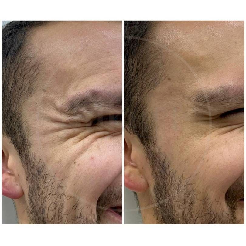 Oscar Iván Lozano Navarrete-8