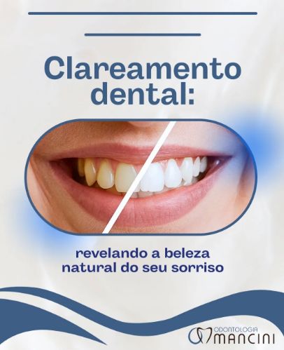 Hermenegildo Mancini-7