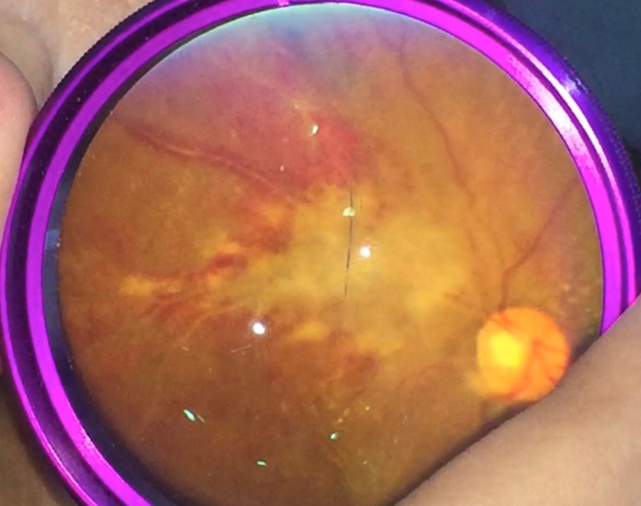 Andrea Tamine Hoyos Dumar-8