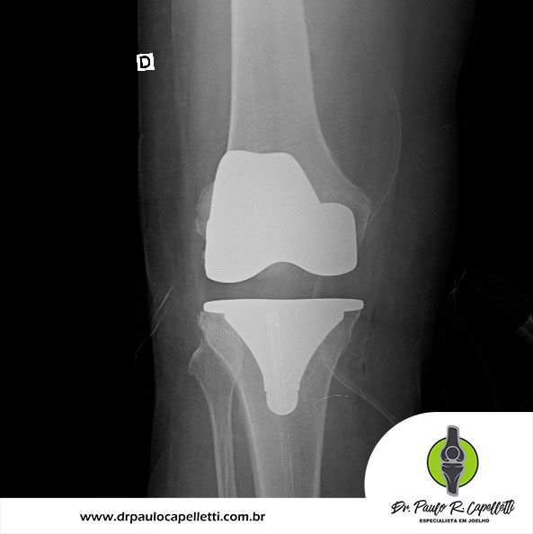 Paulo Roberto Capelletti-57