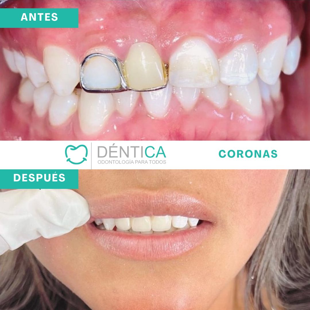 Estefani Canches Caballero-10