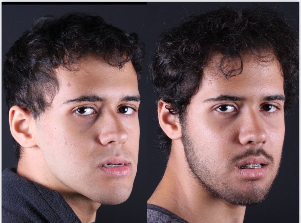 Frederico Carnevale-12