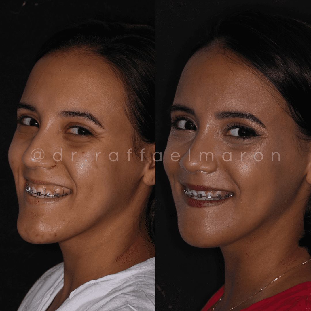 Raffael Maron Vieira De Noronha-26