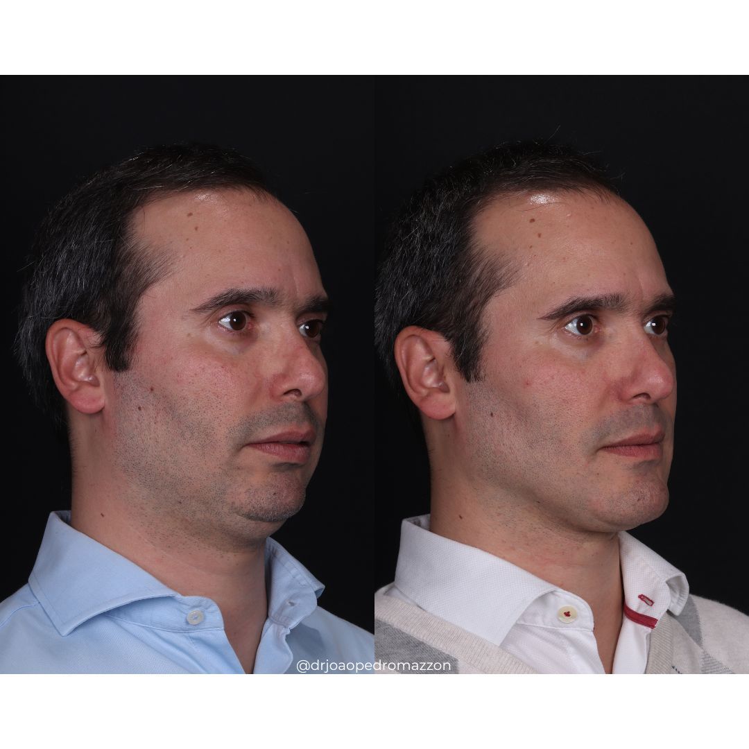 João Pedro Paulino Mazzon-48