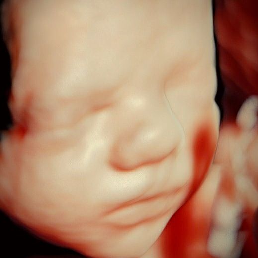 Charles Schwantz De Lima-21