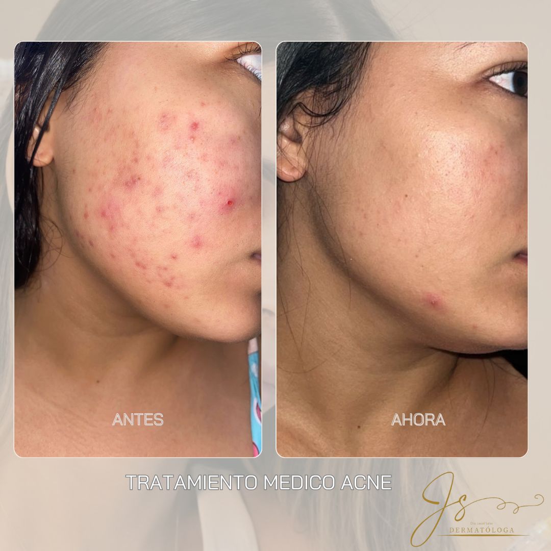 Jasiel Sarai Salas Gomez-11