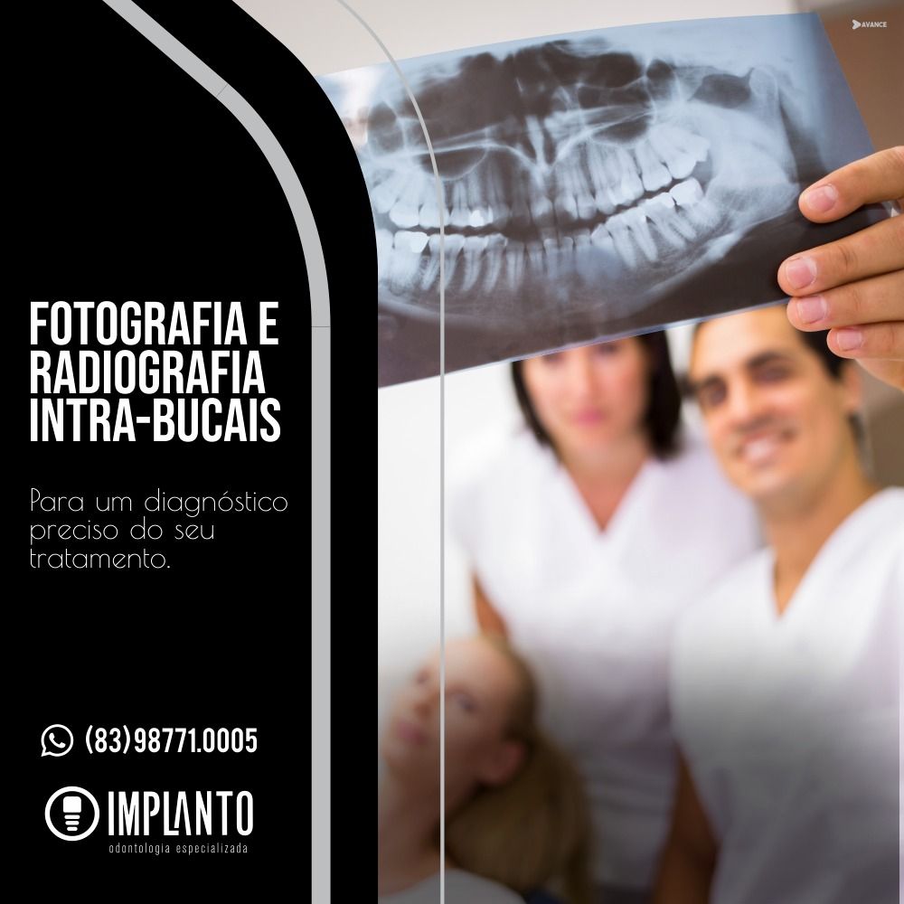 Thiago Candeia Quintans-6