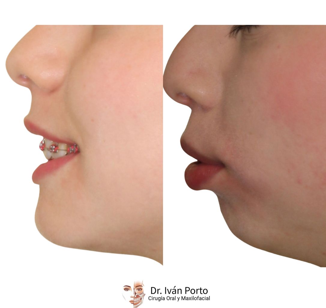 Iván Porto Puerta-4