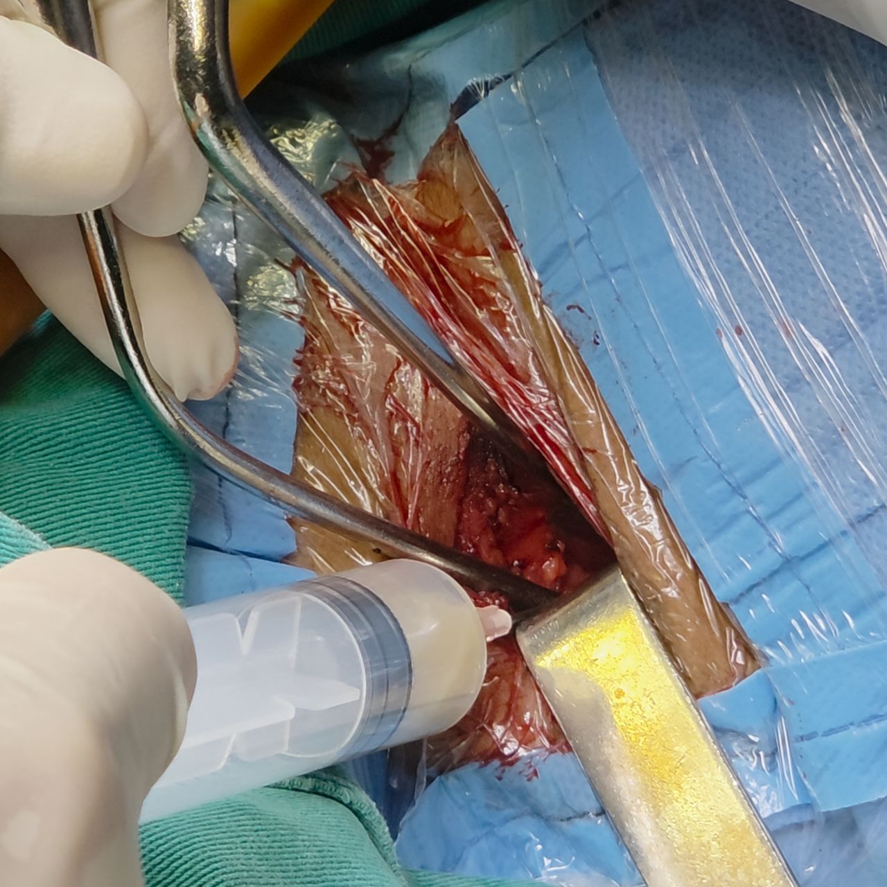 David Tafur Muñoz-2417