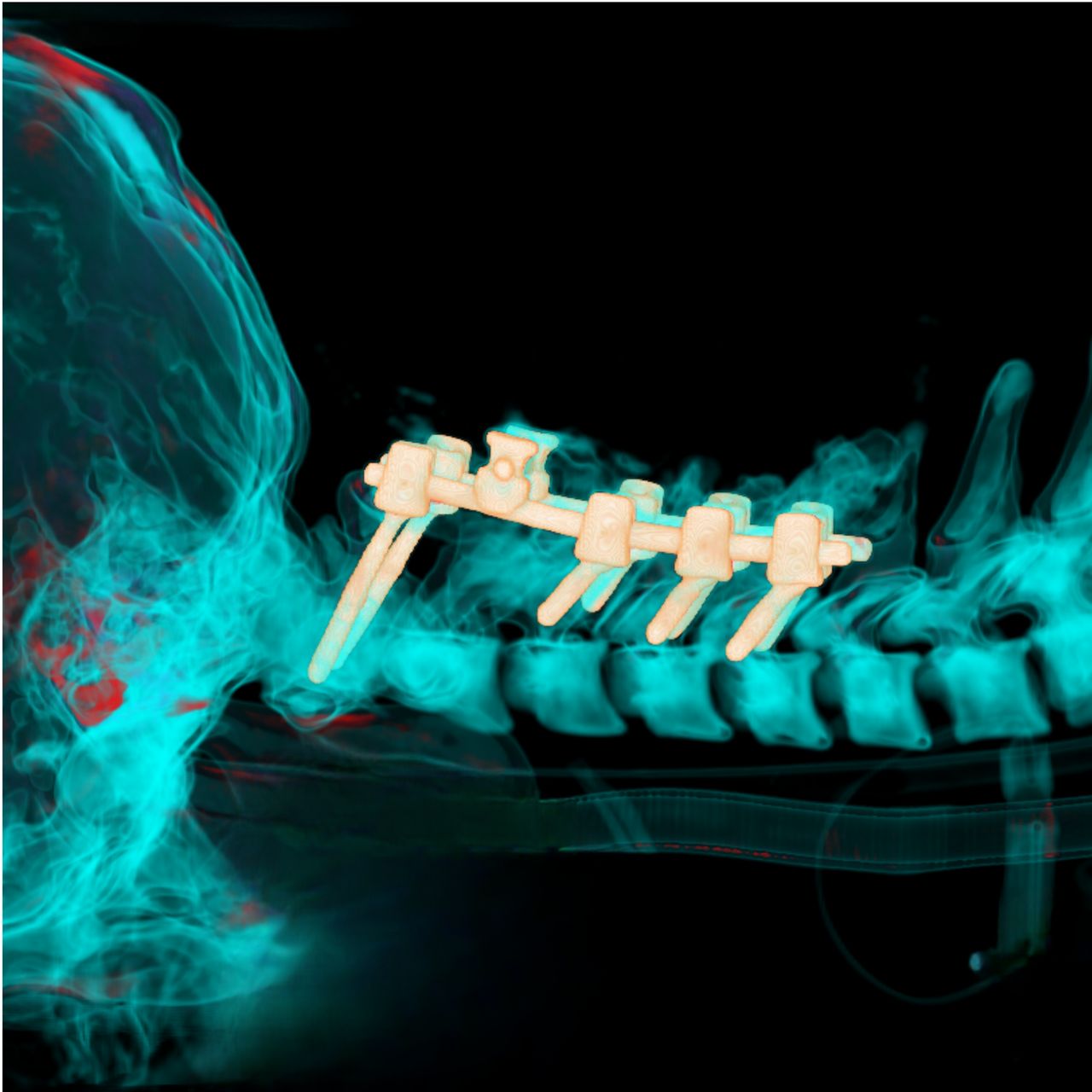 David Tafur Muñoz-1331