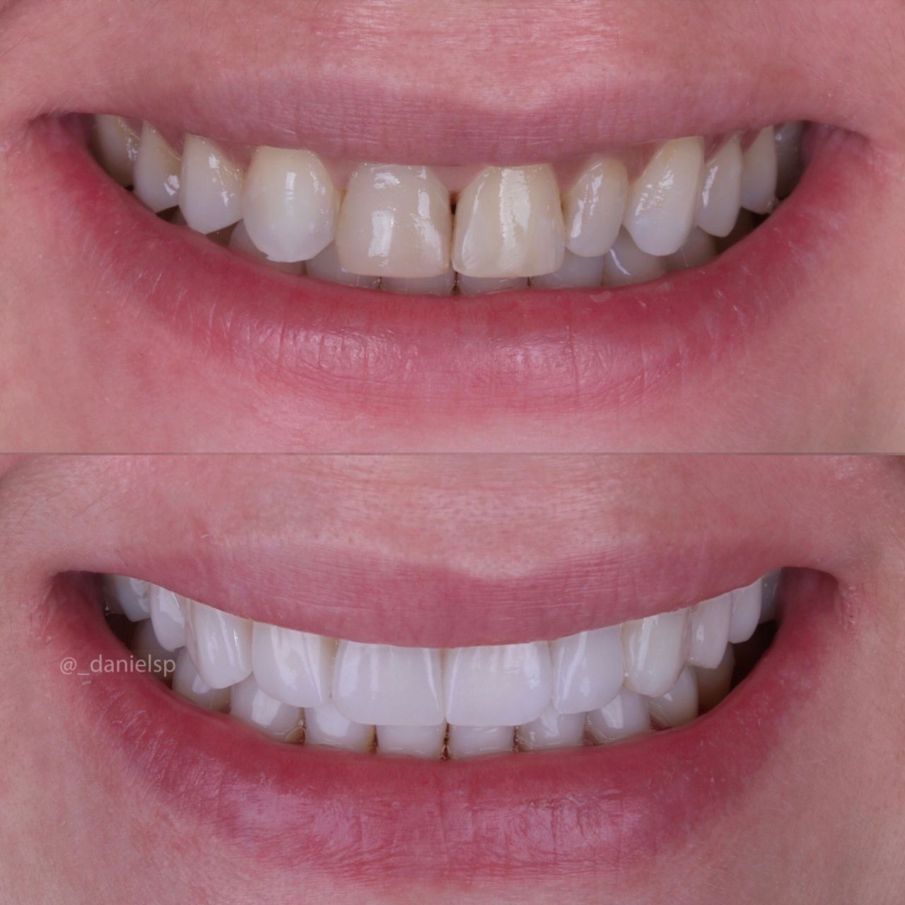 Daniel De Souza Pereira-46