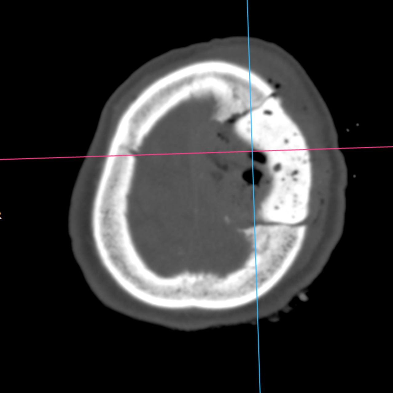 David Tafur Muñoz-2249