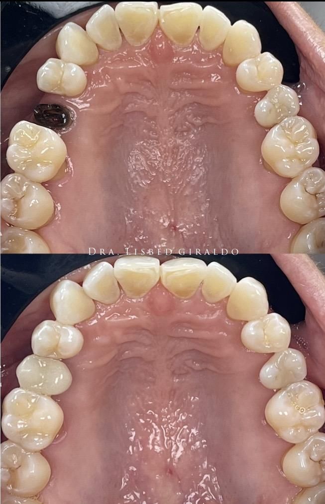 Lisbed Giraldo Olarte-26