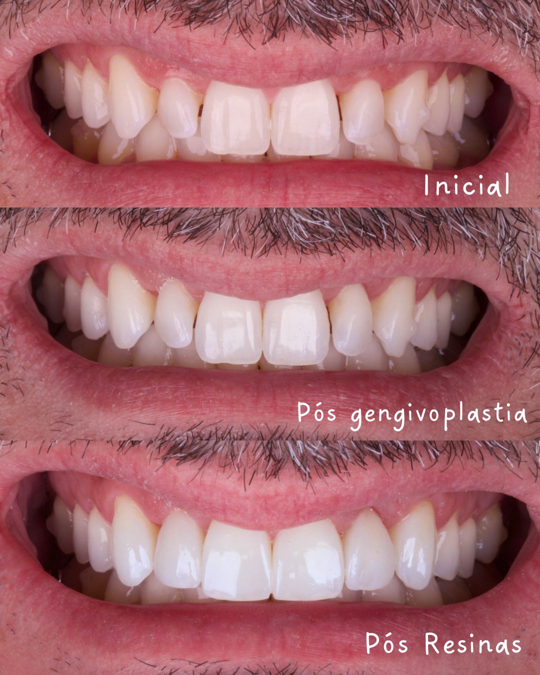 Francine Lauermann-1