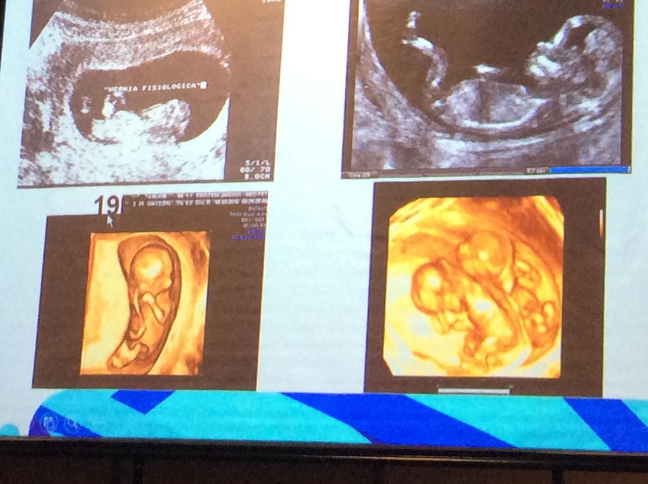 Gilbran Simões Da Silva-1