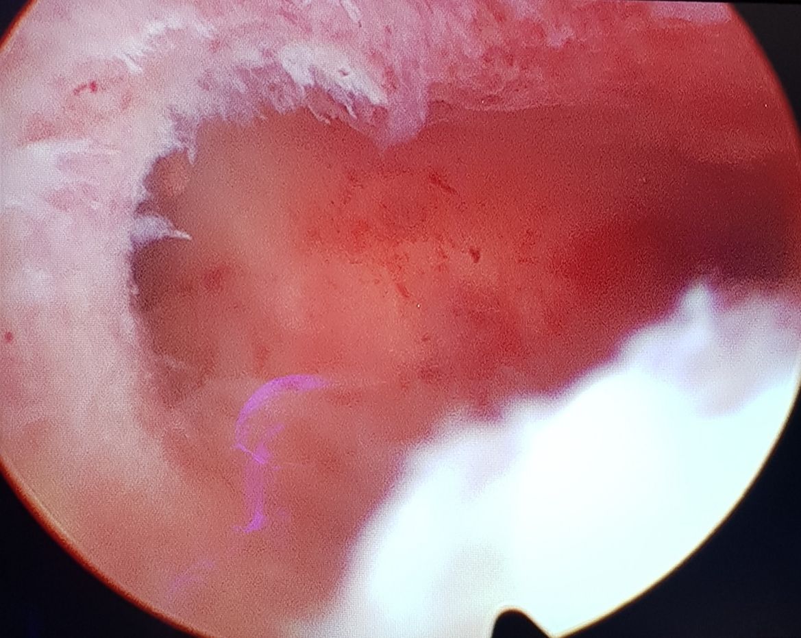 Gislayne Nunes De Souza-7