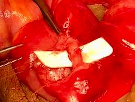 Jorge Mario Rincón Guzmán-3