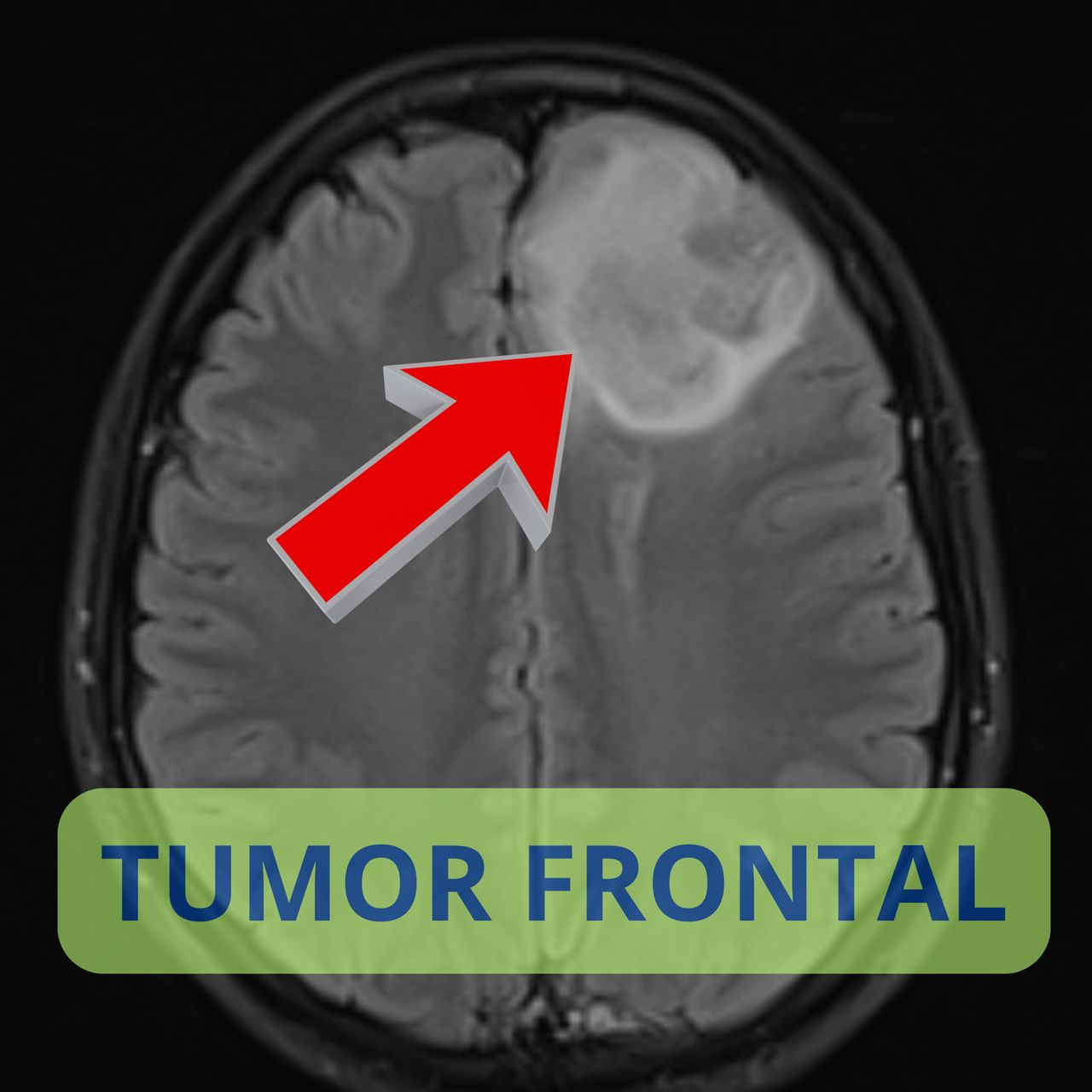 David Tafur Muñoz-2247