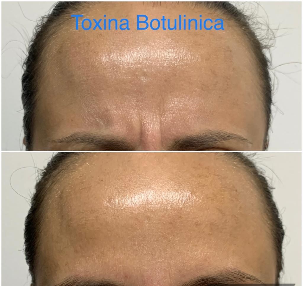 Maria Gisela Angel Losada-83