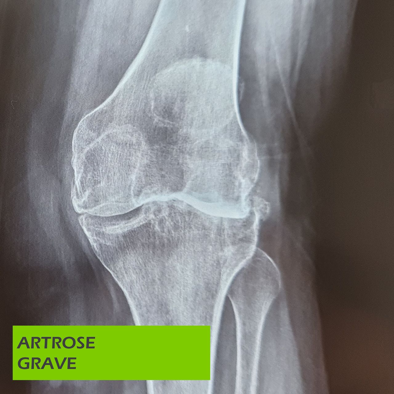 Paulo Roberto Capelletti-36