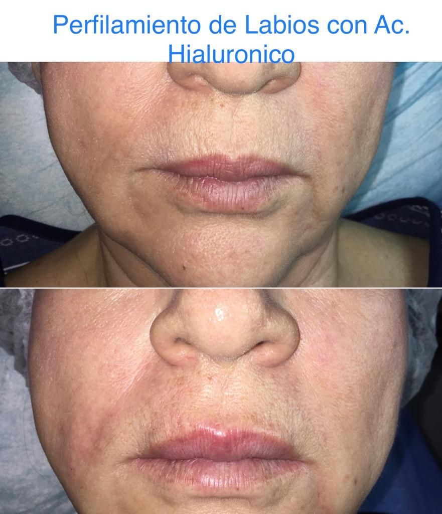 Maria Gisela Angel Losada-44