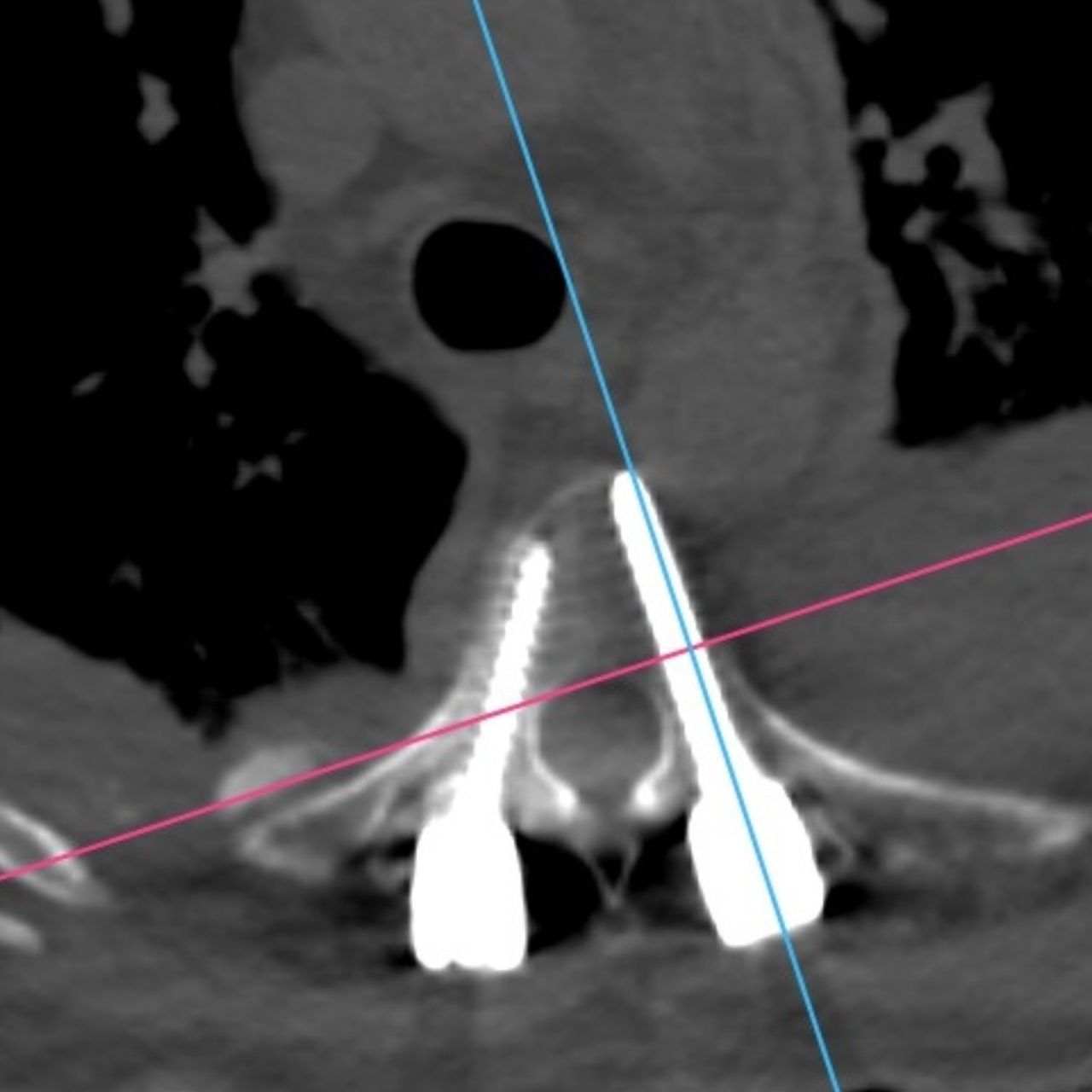 David Tafur Muñoz-1690