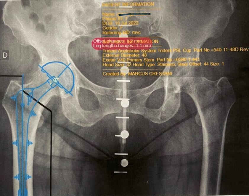 Marcus Vinicius Crestani-2
