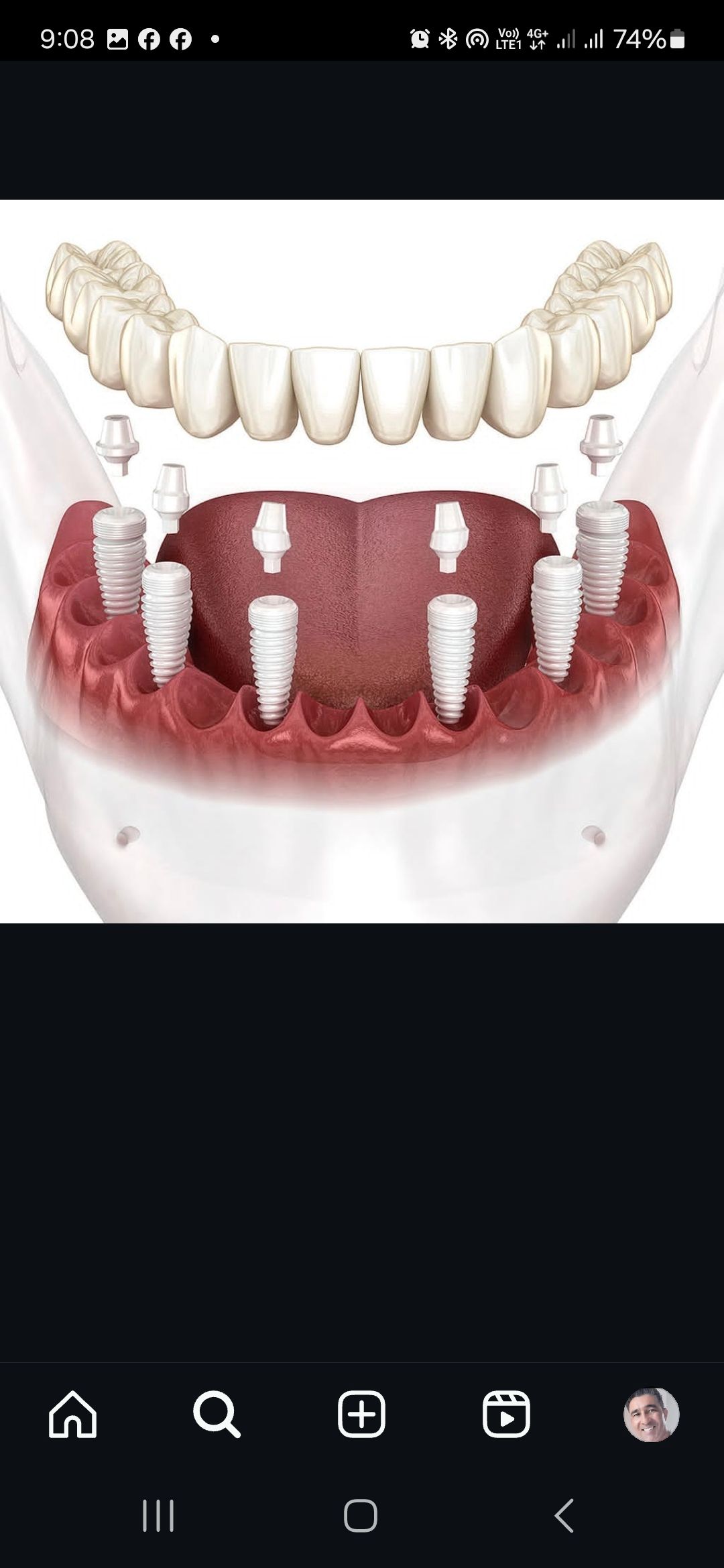 Miguel Angel Bustos Real-5
