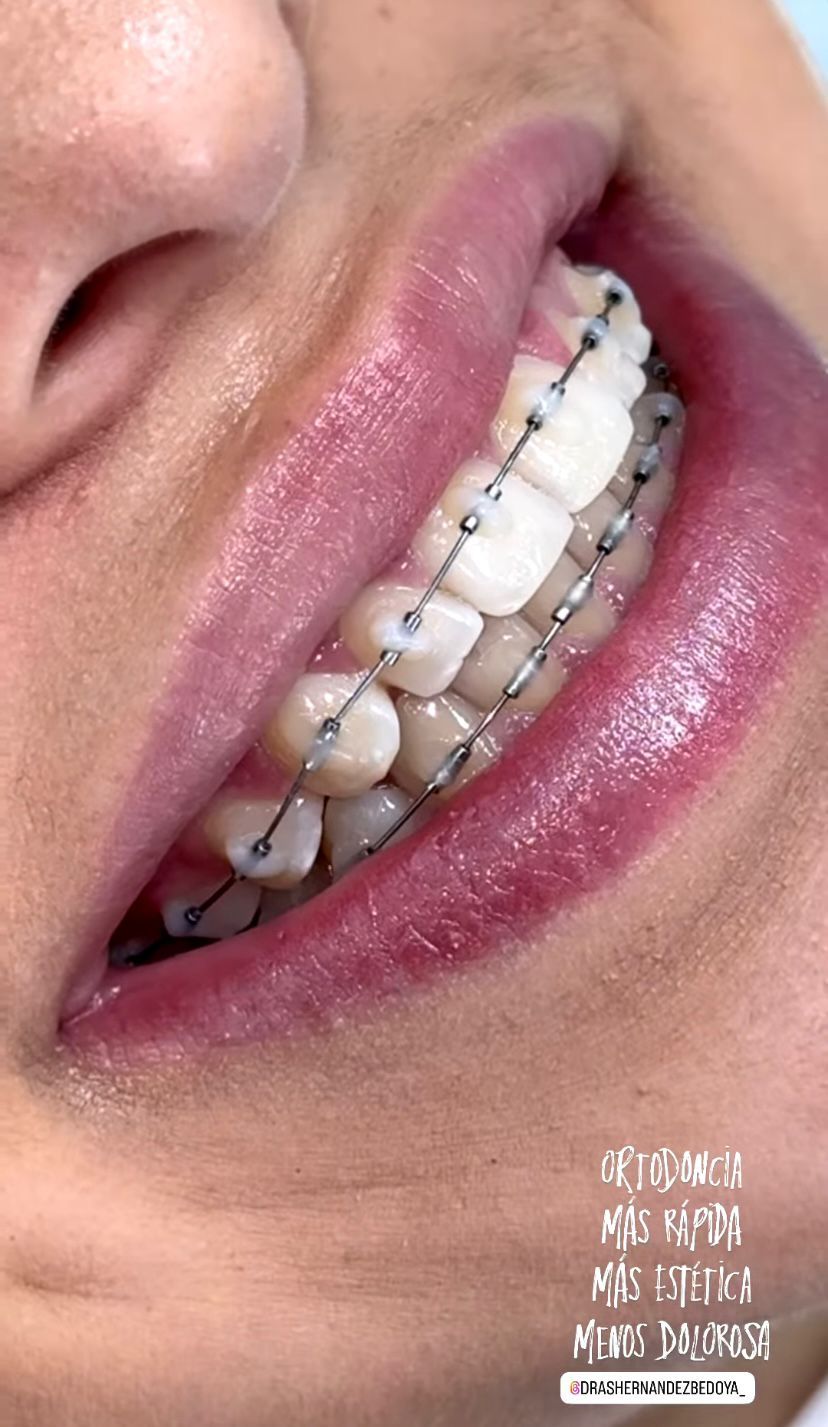 Luisa Fernanda Bedoya Calderón-2