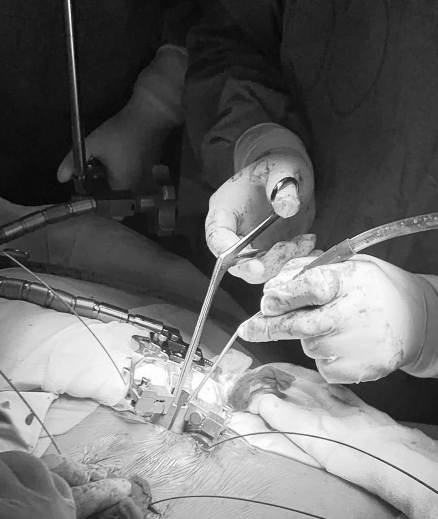 Vladimir Sánchez Ochoa-16