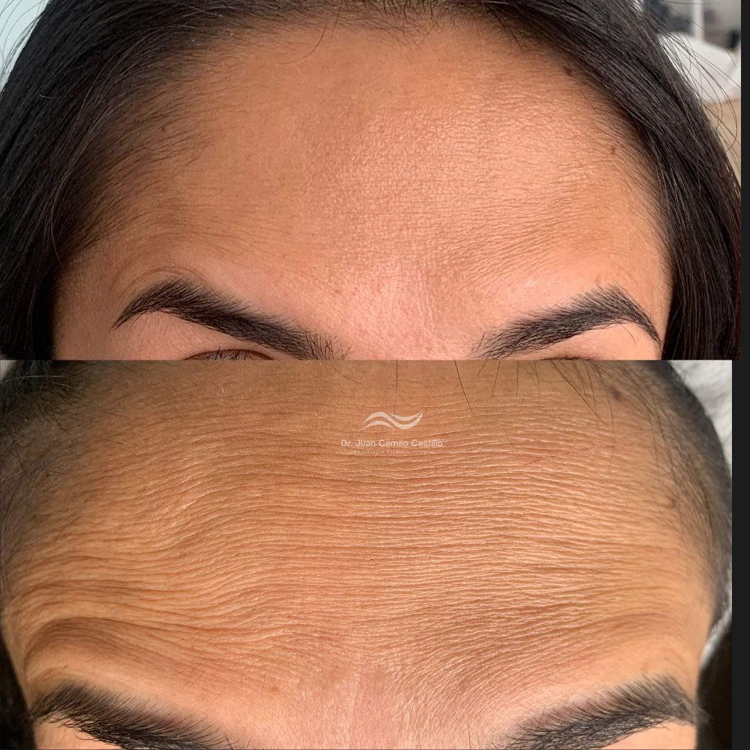 Juan Camilo Castillo-23