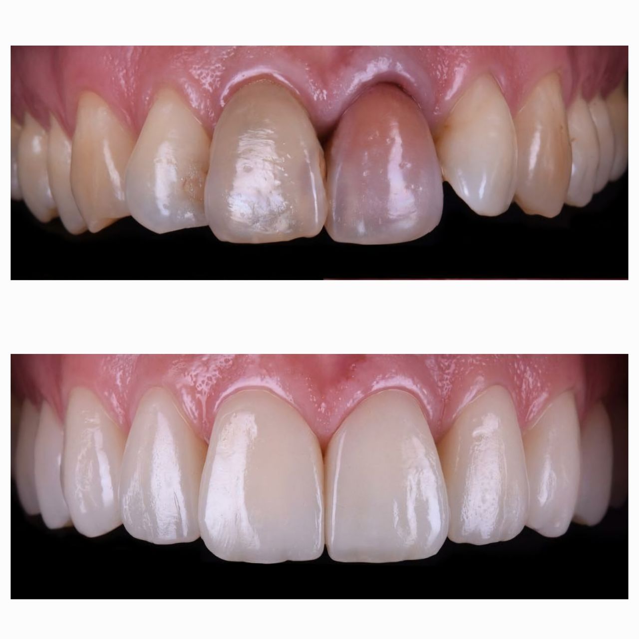 Ana Virginia  Pinheiro -3