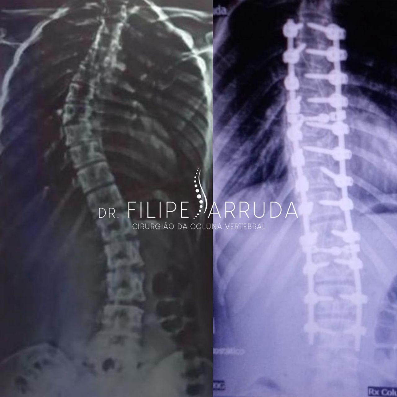 Filipe Arruda-14