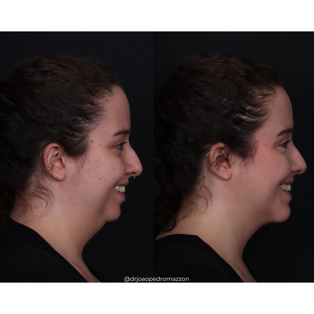 João Pedro Paulino Mazzon-29