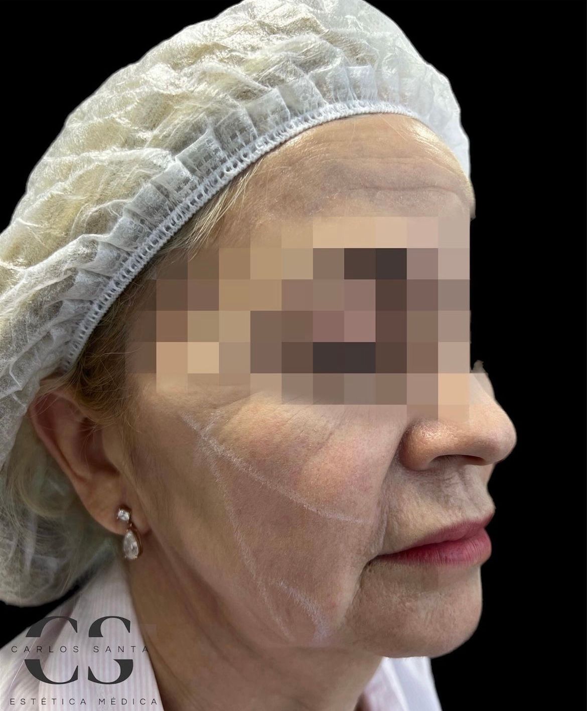 Carlos Andrés Santa-6