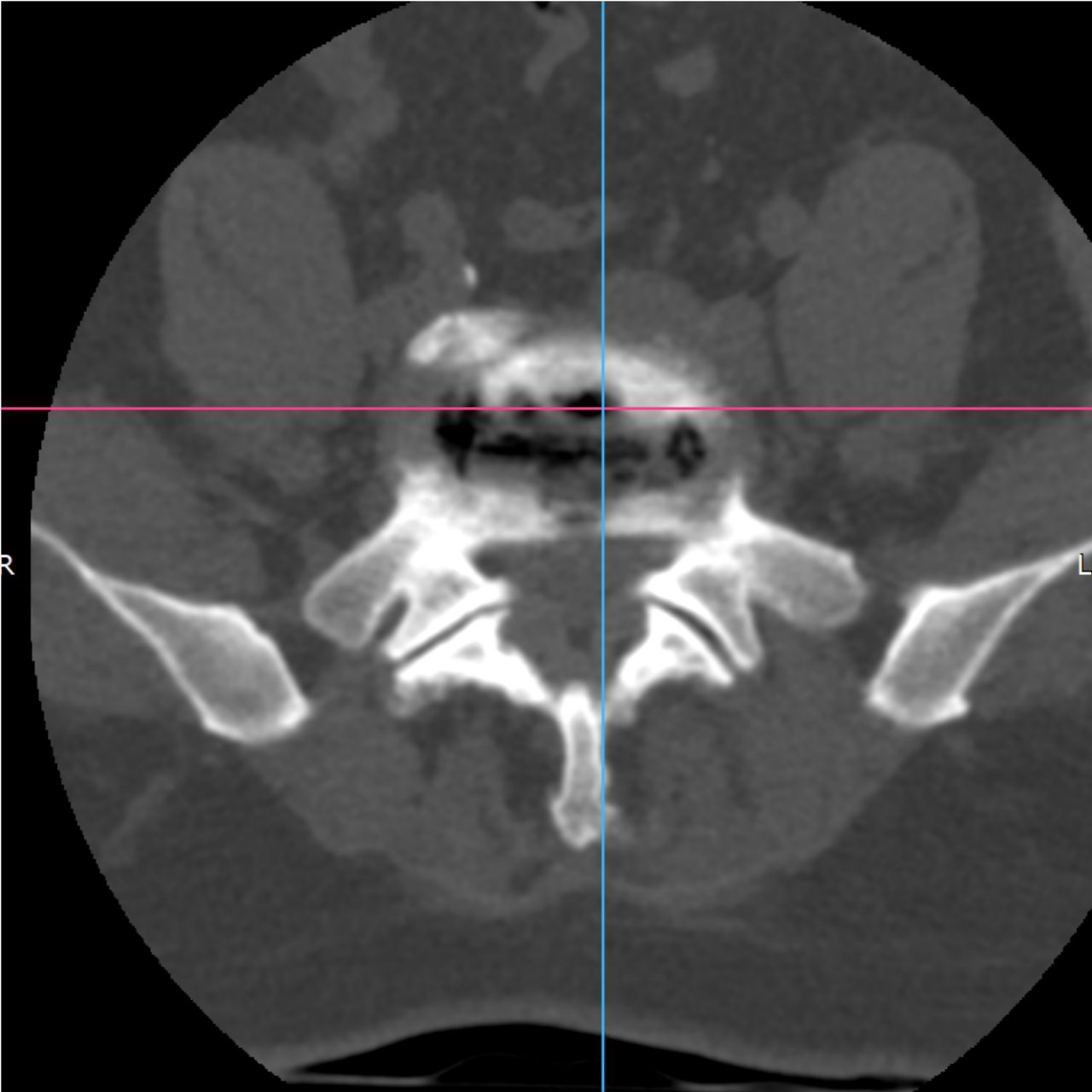 David Tafur Muñoz-2468