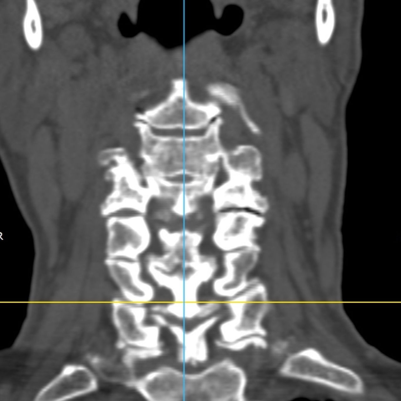 David Tafur Muñoz-1773