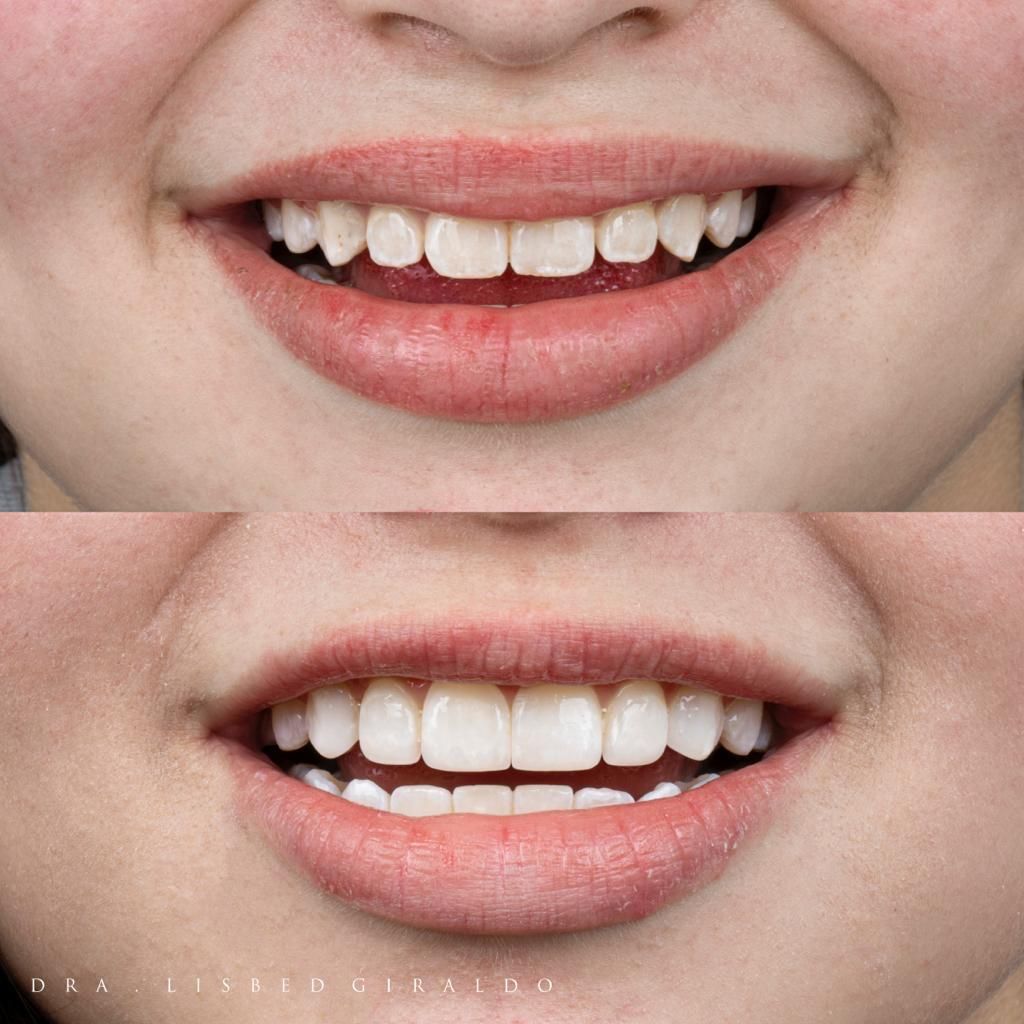 Lisbed Giraldo Olarte-38