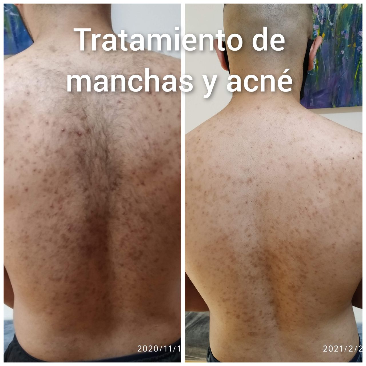 Alejandra Meijide-32