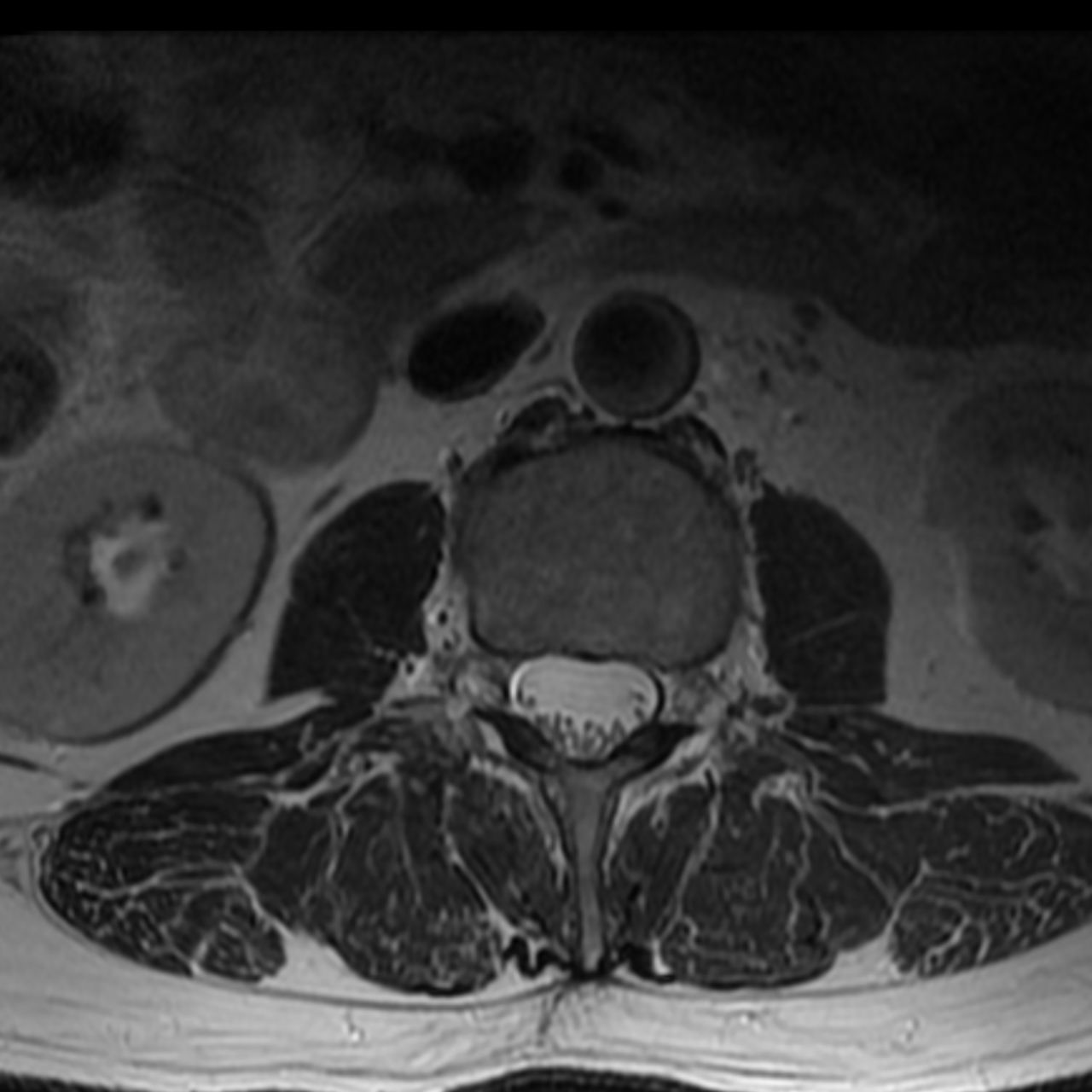 David Tafur Muñoz-1726