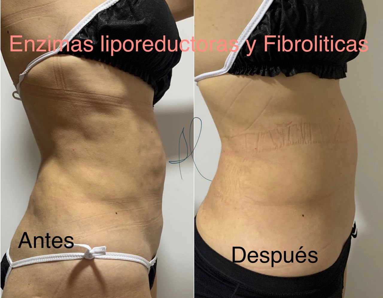 Maria Gisela Angel Losada-15