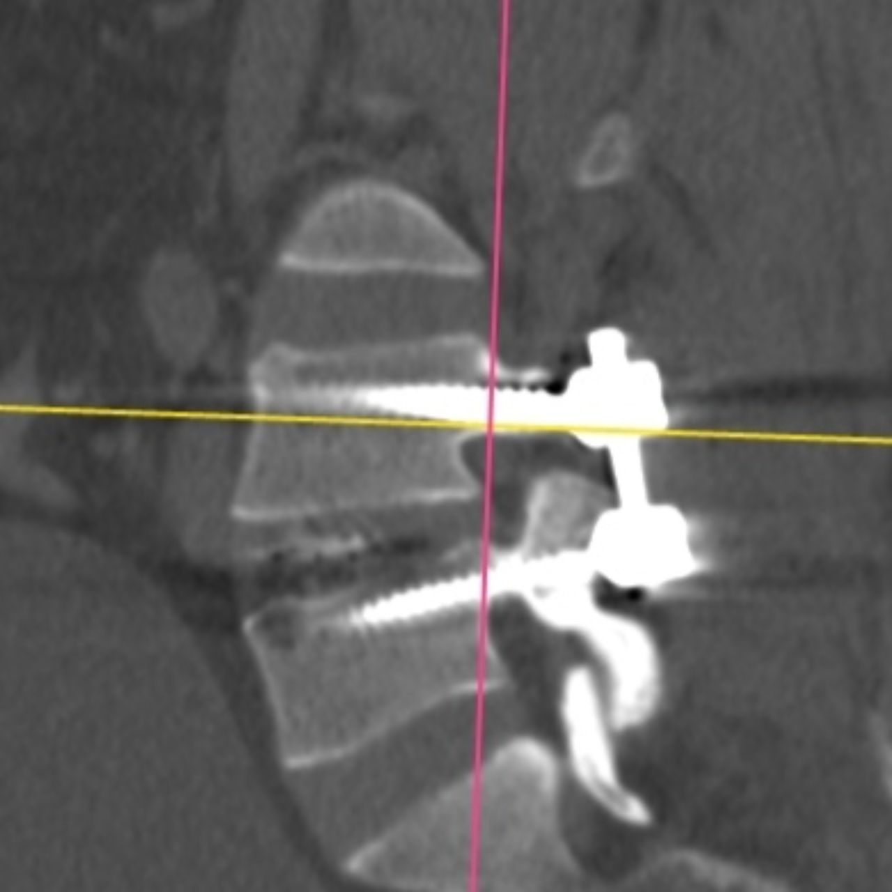 David Tafur Muñoz-1833