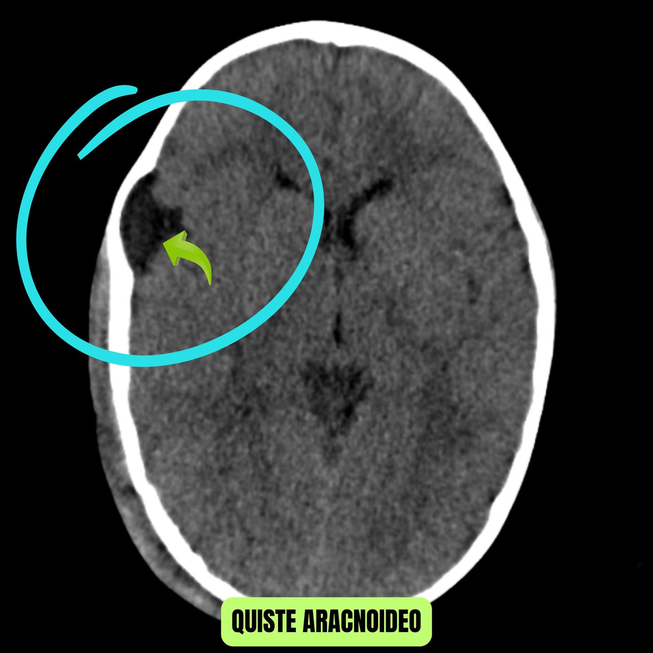 David Tafur Muñoz-1044