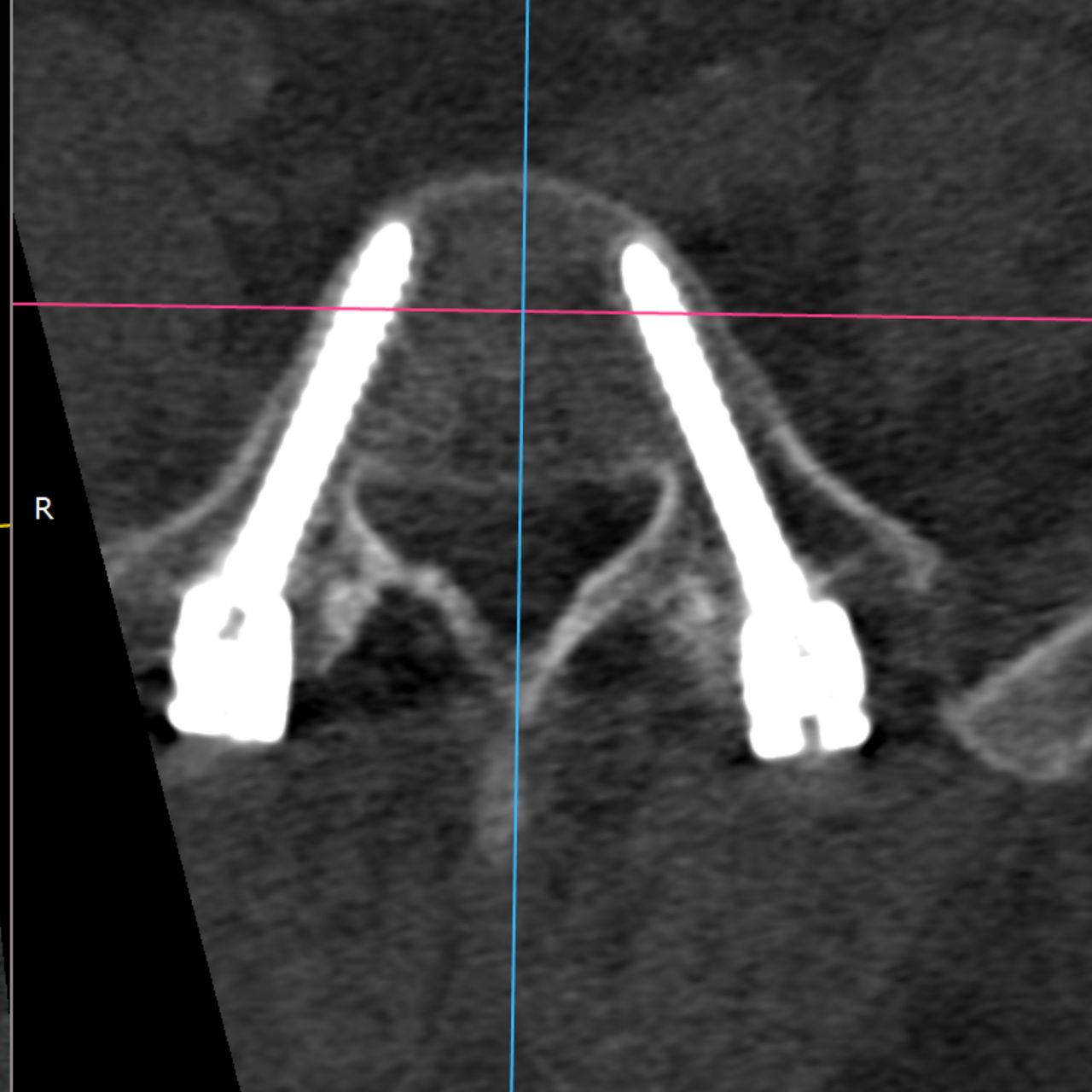David Tafur Muñoz-1749