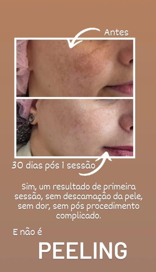 Ana Paula Andreolla-2