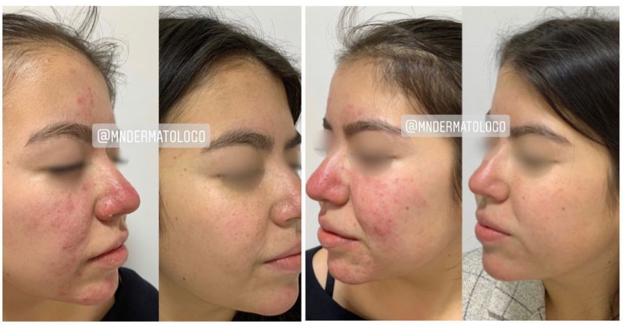 Mario Naranjo Otero-15