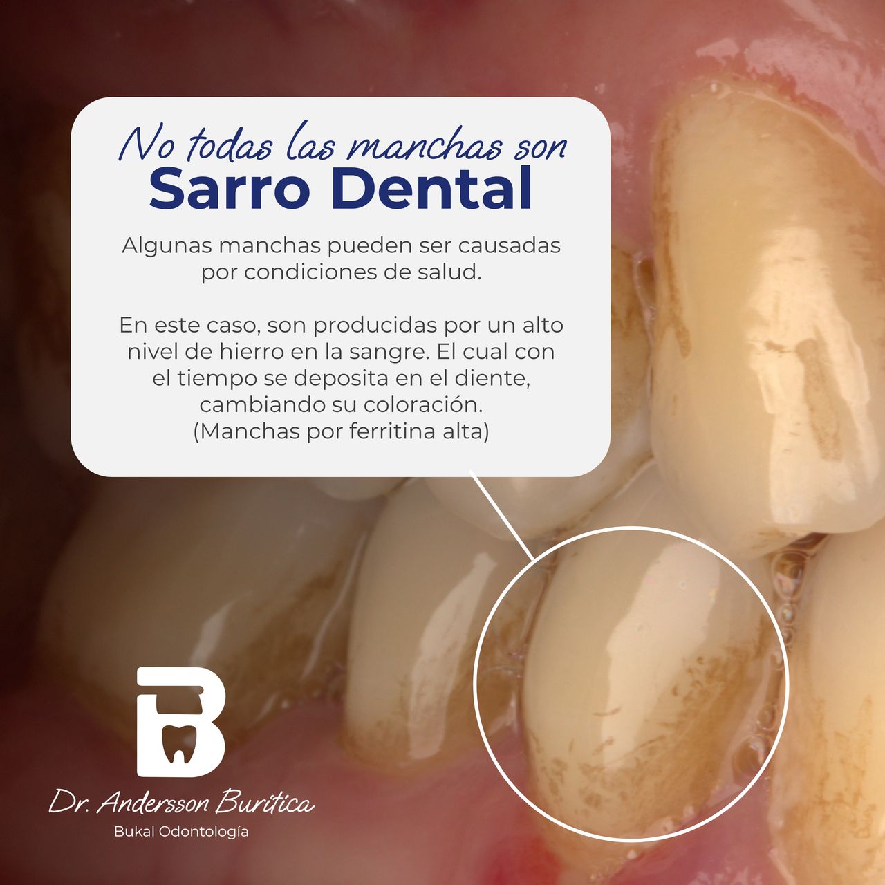 Andersson Buritica-12