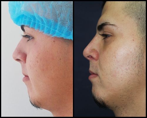 Jorge A Holguin Ruiz-9